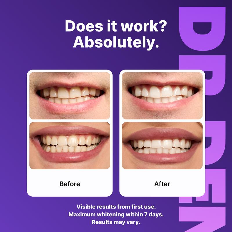 VIOBRIGHT Whitening Strips