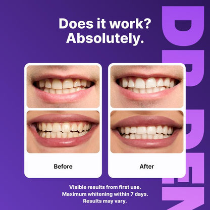 VIOBRIGHT Whitening Strips